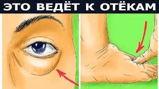 Эти продукты ведут к Отёкам || Это надо Знать!