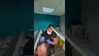 SMP (Scalp Micro Pigmentation) treatment #haircare #hairgrowth #hair #hairlosshelp #hairloss