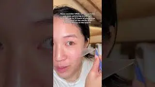 My skin is peeling 🙈😱