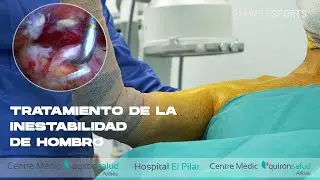 TRATAMIENTO DE LA INESTABILIDAD DE HOMBRO (Recurrent shoulder dislocation)