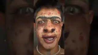 Ужас какой страшный. Такой красивый мальчик 👍. 