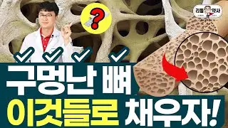 숭숭 구멍난 뼈! 먹으면서 채워주세요. 골다공증을 위한 영양소!