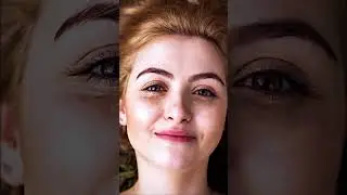 #Skin