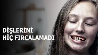 Dişlerinizi Fırçalamayı Bırakırsanız, 1 Yıl İçinde Başınıza Bunlar Gelecek..! 