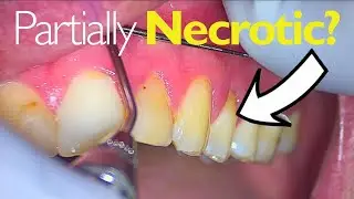 Why TOOTH PAIN can be HARD to Diagnose...