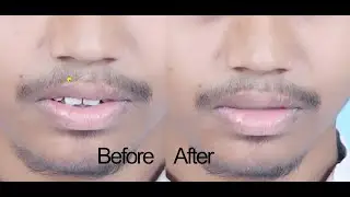 How to Close the Lips in 5 Second in Photoshop