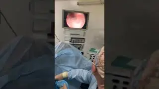 This is what bloodless prostate adenoma removal looks like