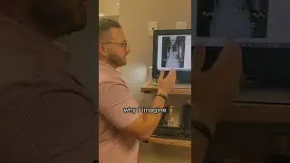 (2/3) Scoliosis curving INTO heart?!
