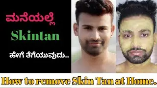 How to remove Skintan at home | Kannada men's grooming | Kannada beauty tips | Vihaan Surya