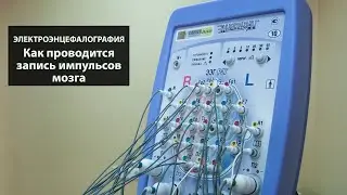 Электроэнцефалография. Как проводится ЭЭГ? Тест на эпилепсию и интересный эксперимент.