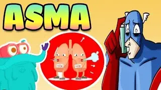 Sindromes respiratorios   Asma Bronquial