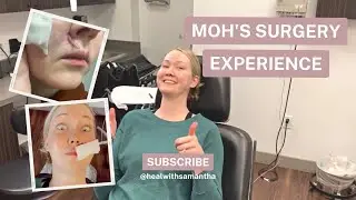 My surprising journey from diagnosis to Mohs surgery...