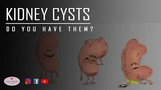 Kidney Cysts | Do You Have Them?