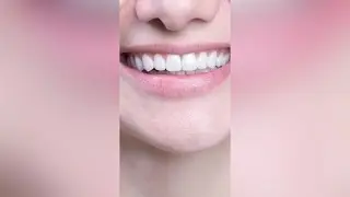 How Long do Veneers Last? | Dental Health