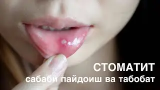 СТОМАТИТ аз кучо пайдо мешавад ва чи хел табобат мешавад?