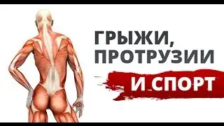 Межпозвоночные грыжи и протрузии и спорт. Часть 3. Общее и нюансы