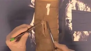Subcutaneous Suture Pattern