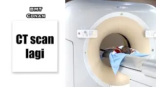 CT SCAN LAGI