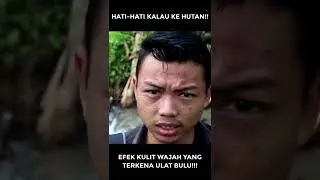Efek kulit wajah jika terkena ulat bulu