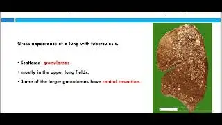 infectious diseases 2.