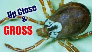 Tick Under A Microscope!