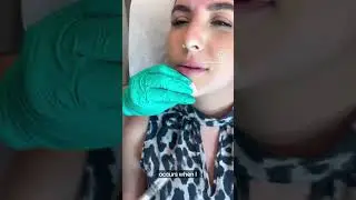 Jeuveau treatment at The Waltzman Institute!