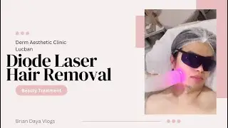 Diode Hair Laser Removal