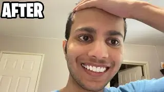Hairline Reveal💀