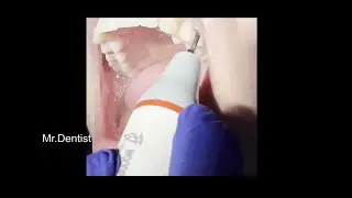 Therapy With Ultrasonic Scaler To Treat Periodontal Pockets  !!!!!