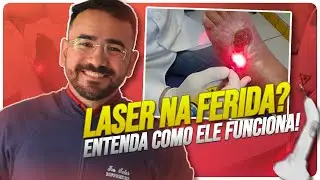 LASER NA FERIDA FUNCIONA? ENTENDA COMO A LASERTERAPIA ACELERA A CICATRIZAÇÃO