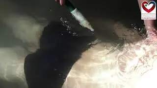 Гидромассаж
