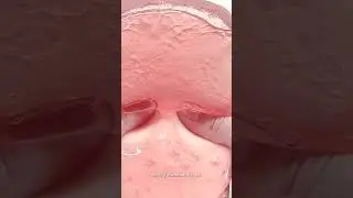 ASMR smile Pinkk💗💖💓#asmr #smile #pink #video #musik #love 💖