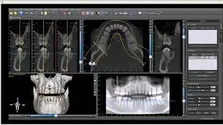 Tangential View Mode in Blueskybio DSoftware in Russian