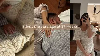 we lost our baby 💔 silent miscarriage at 17 weeks