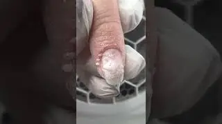 🔥