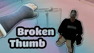 Broken Thumb // Pick-up Hockey // September 26, 2020