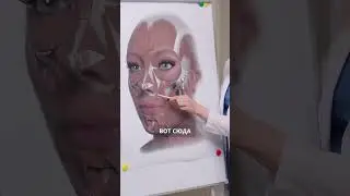 БОТОКС ОПАСЕН ⁉️