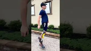 Hemipelvectomy Amputee Running with Prosthetic Leg | Kristofer