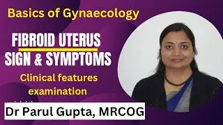 Uterine Fibroid : Sign & Symptoms | Clinical features |