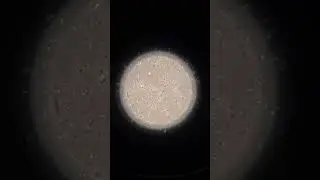 Sperm under a microscope