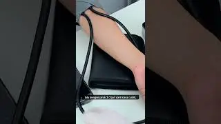 Hitung Bleeding Time Langsung di Tempat Praktik!
