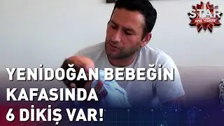 Yenidoğan Bebeğin Kafasında 6 Dikiş Var