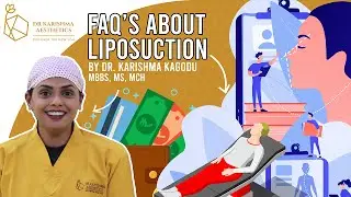 Liposuction Frequently Asked Questions | Dr. Karishma Aesthetics, Bengaluru, India