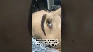 Removia ou esperava? 