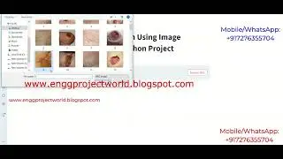 Detection Of Ulcer Disease Using Image Processing Python Project With Source Code Ulcer Detection