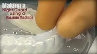 Technique for Making a Night Guard Using Vacuum Machines