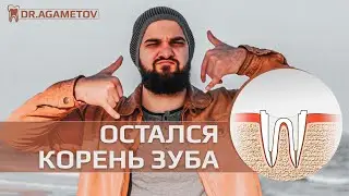 От зуба остался корень. Как восстановить? Что делать?