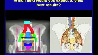 Advances in Radiotherapy for Prostate Cancer   Dr  J Efstathiou