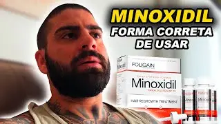 FORMA CORRETA DE APLICAR MINOXIDIL | BARBA PRETA