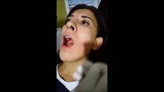Gamzesini Deldirdi !!!  (Dimple Piercing)
